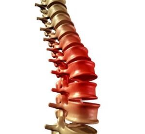 spine surgery