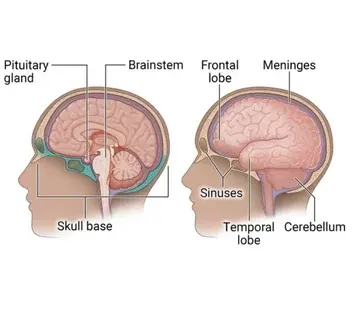 Other Skull Base Procedures (as needed)